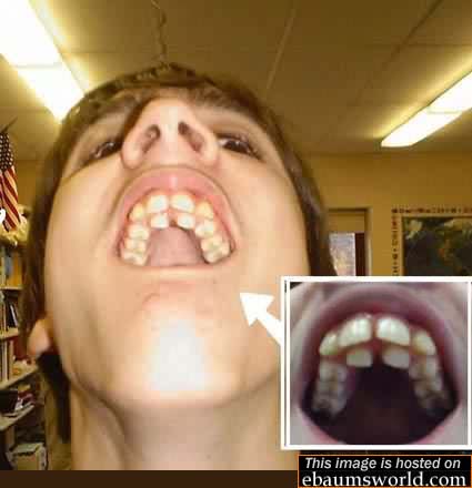 doubleteeth.jpg